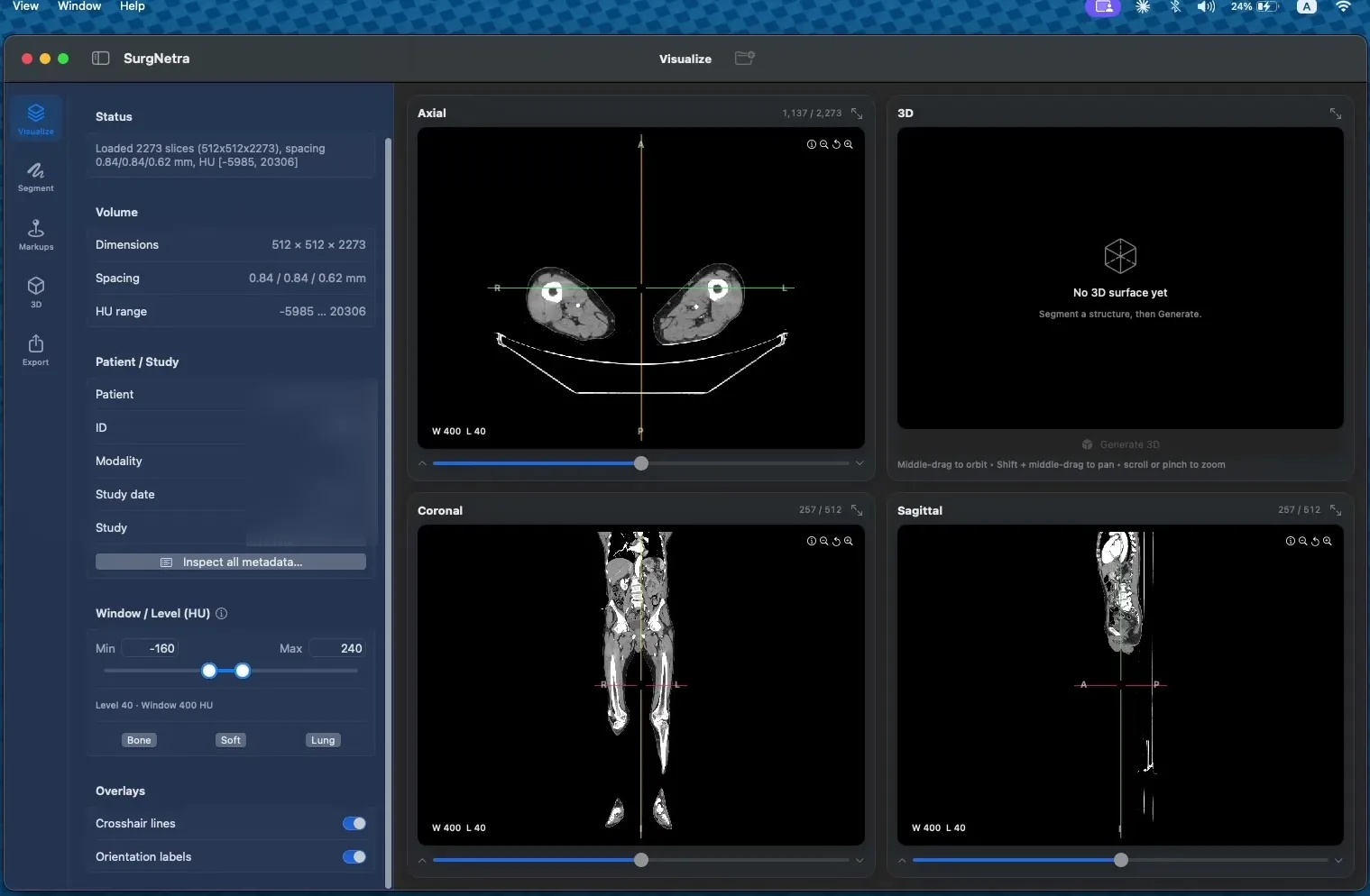 Application showing a loaded CT series in axial, coronal and sagittal views with volume metadata