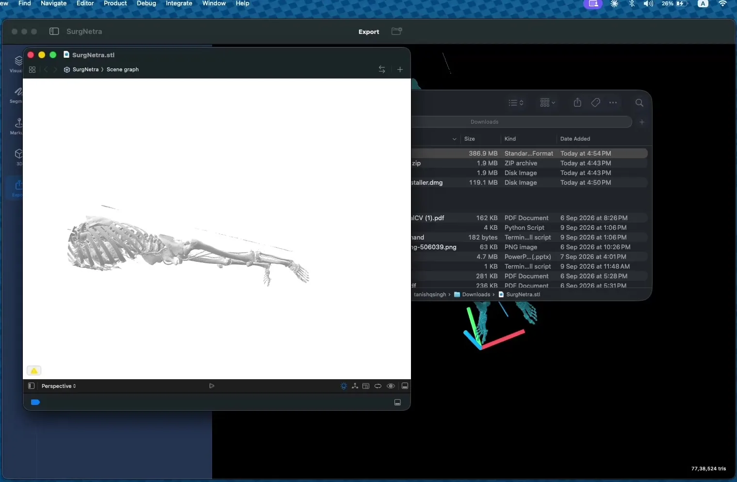 Exported STL mesh of forearm bones previewed on a white background