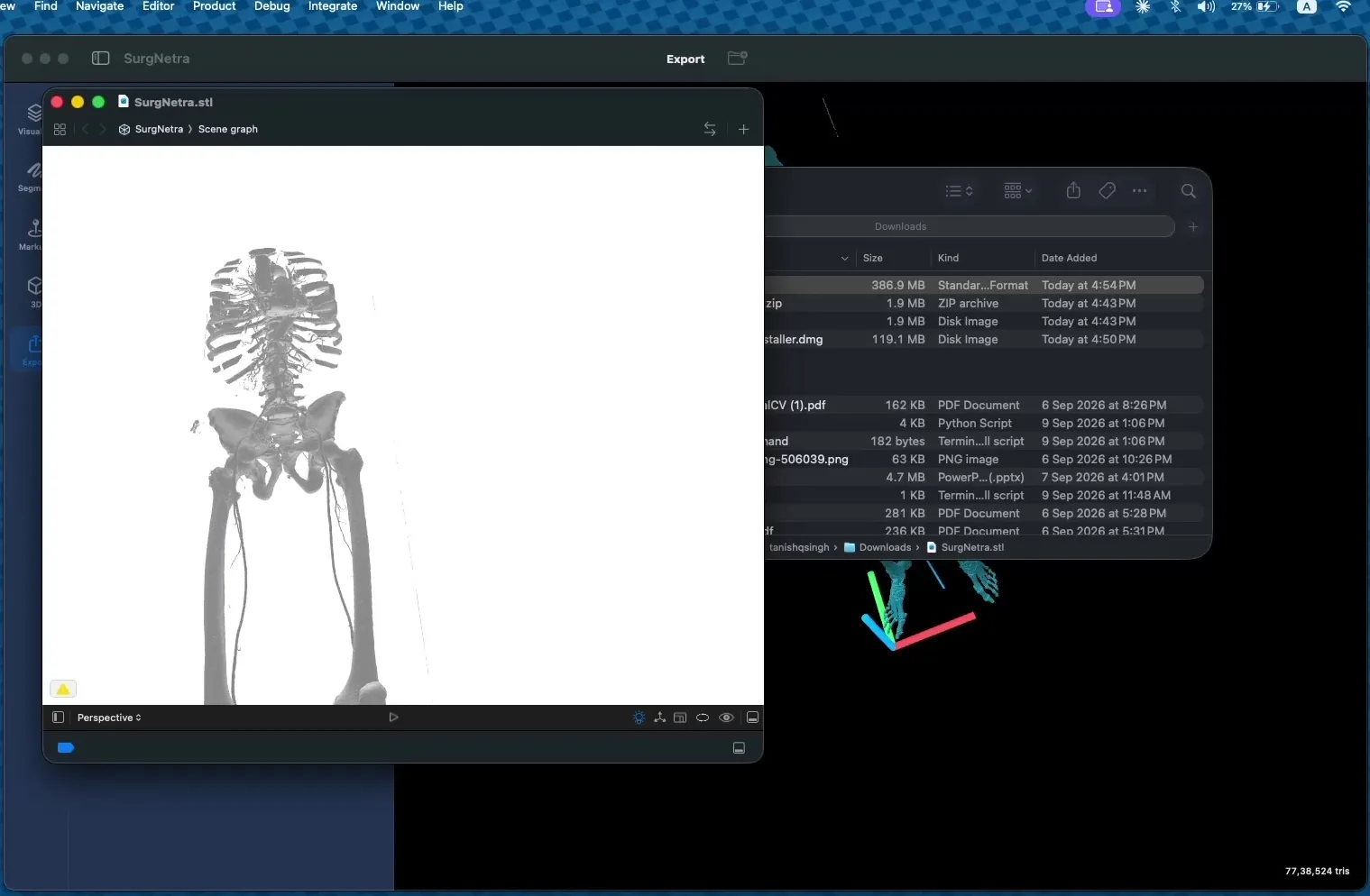Exported STL mesh of pelvis and leg bones previewed on a white background